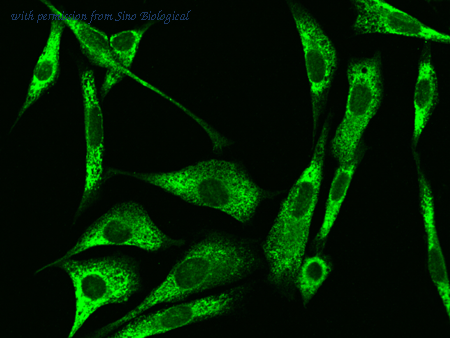 Sino Biological 50638-R016 image 1