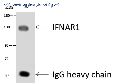 Sino Biological 13222-T20 image 1