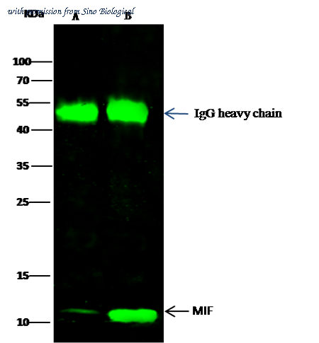 Sino Biological 50066-T52 image 1