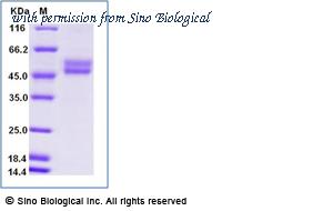 Sino Biological 10473-H02H image 1