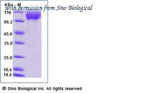 Sino Biological 50529-M08H image 1