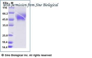 Sino Biological 10738-H27H-B image 1