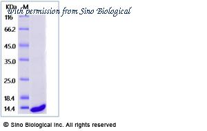 Sino Biological 40533-V08H image 1