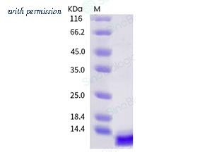 Sino Biological 40543-V08H-B image 1