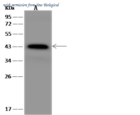 Sino Biological 201537-T32 image 1