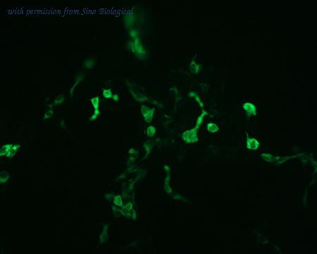 Sino Biological HG10011-NF image 1
