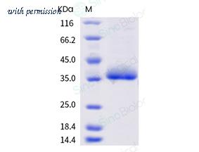 Sino Biological 40592-V08H83 image 1