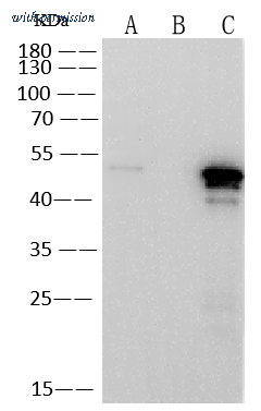 Sino Biological 40588-MM123 image 1