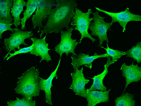 Sino Biological 10246-T54 image 1