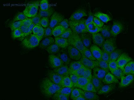 Sino Biological 106999-T34 image 1