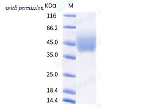 Sino Biological 16140-H08H-B image 1