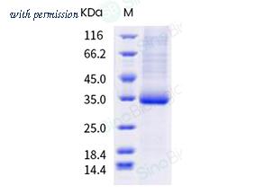 Sino Biological 40592-V08H100 image 1