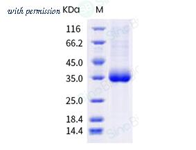 Sino Biological 40592-V08H102 image 1