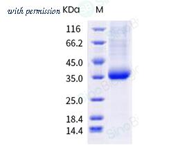 Sino Biological 40592-V08H104 image 1