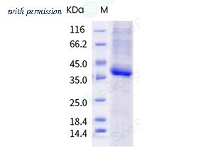 Sino Biological 40592-V08H105 image 1