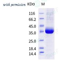 Sino Biological 40592-V08H106 image 1