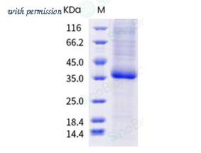 Sino Biological 40592-V08H98 image 1