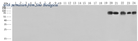 Sino Biological 40438-MM05 image 1