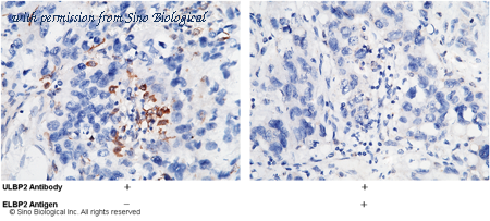 Sino Biological 12143-RP02 image 1