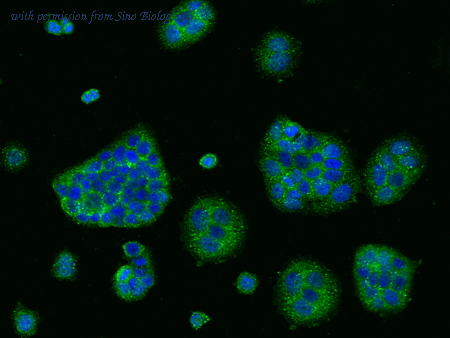 Sino Biological 12283-T26 image 1