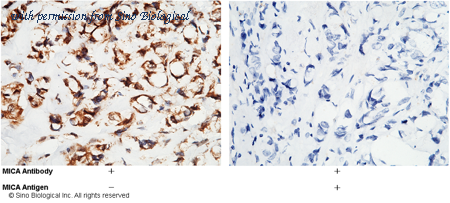 Sino Biological 12302-RP02 image 1