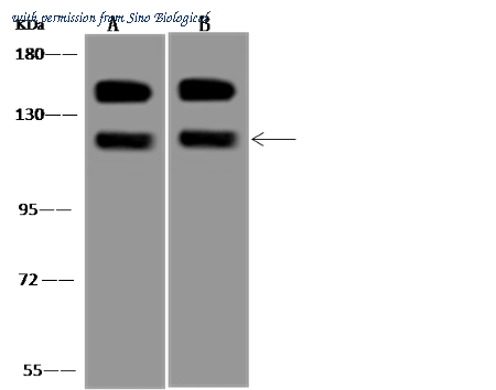 Sino Biological 201128-T44 image 1