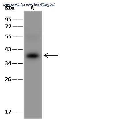 Sino Biological 201546-T36 image 1