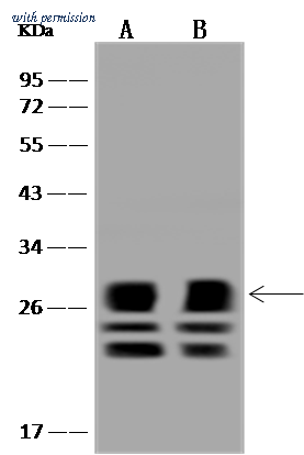 Sino Biological 202002-T44 image 1