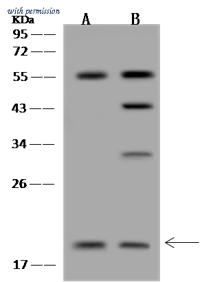 Sino Biological 204335-T44 image 1