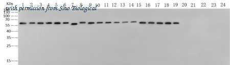 Sino Biological 40205-MM16 image 1