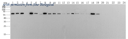 Sino Biological 40205-MM18 image 1