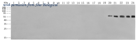Sino Biological 40438-MM10 image 1