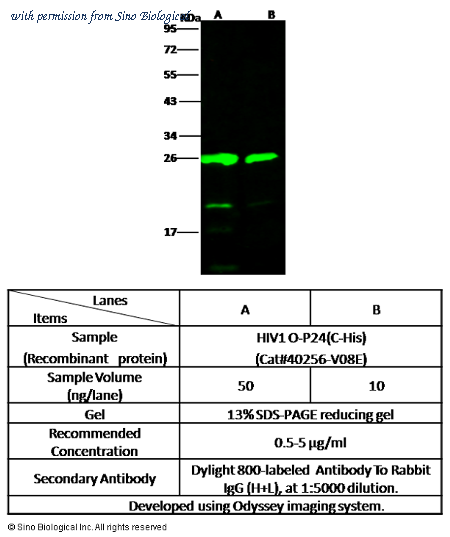 Sino Biological 40256-T62 image 1