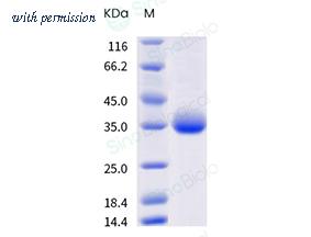 Sino Biological 40592-V08H111 image 1