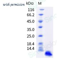 Sino Biological 90914-CNAH image 1