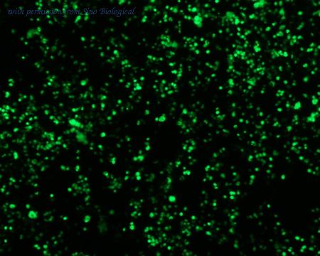 Sino Biological HG11040-ACG image 1