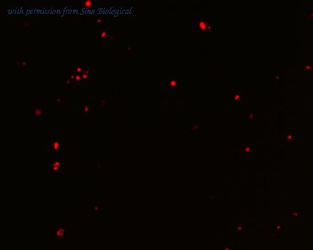 Sino Biological HG11346-ACR image 1