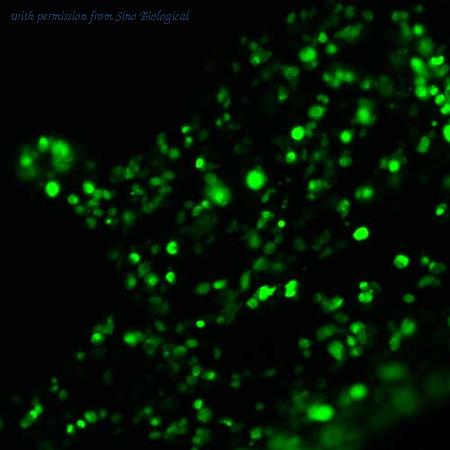 Sino Biological HG11652-ACG image 1