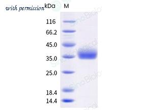 Sino Biological 40592-V08H138 image 1