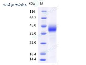 Sino Biological 10773-H56H-B image 1