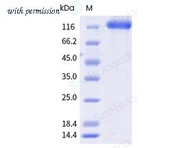 Sino Biological 10445-H41H-B image 1
