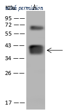 Sino Biological 205271-T44 image 1