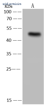 Sino Biological 204006-T32 image 1