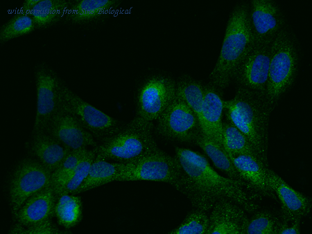 Sino Biological 203241-T02 image 1