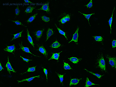 Sino Biological 14567-R006 image 1