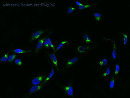 Sino Biological 13863-M302 image 1