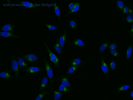 Sino Biological 13863-M240 image 1