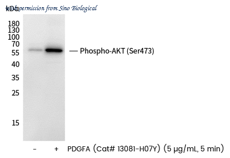 Sino Biological 110852-R0069 image 1