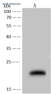 Sino Biological 105015-T36 image 1