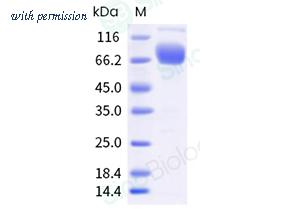 Sino Biological 10698-H41H-B image 1
